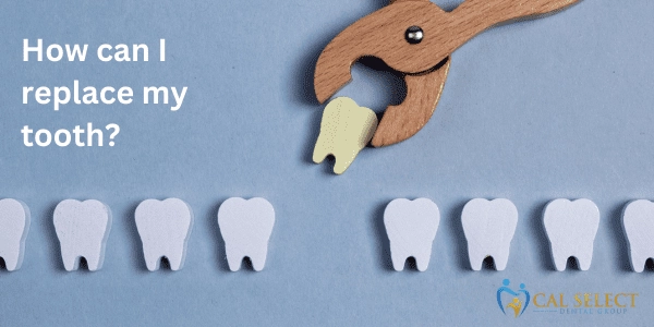 How Can I Replace My Tooth? :: Cal Select Dental